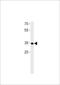 Rhox Homeobox Family Member 2B antibody, 60-367, ProSci, Western Blot image 