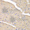 Voltage Dependent Anion Channel 1 antibody, A0810, ABclonal Technology, Immunohistochemistry paraffin image 