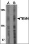 Rho guanine nucleotide exchange factor 17 antibody, orb88743, Biorbyt, Western Blot image 