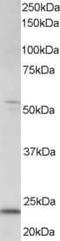 MAX Dimerization Protein 4 antibody, PA5-18097, Invitrogen Antibodies, Western Blot image 