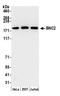 Zinc finger protein basonuclin-2 antibody, A305-487A, Bethyl Labs, Western Blot image 