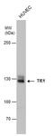 Tyrosine Kinase With Immunoglobulin Like And EGF Like Domains 1 antibody, PA5-27903, Invitrogen Antibodies, Western Blot image 