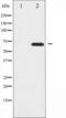 Rac GTPase-activating protein 1 antibody, TA325784, Origene, Western Blot image 