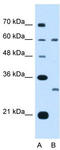 Tetraspanin 32 antibody, TA339019, Origene, Western Blot image 
