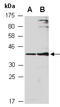 Zinc Finger DHHC-Type Containing 4 antibody, R2220-2, Abiocode, Western Blot image 