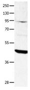 Dual Specificity Phosphatase 4 antibody, orb107384, Biorbyt, Western Blot image 
