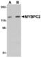 Myosin Binding Protein C, Fast Type antibody, LS-B5081, Lifespan Biosciences, Western Blot image 