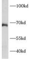 Breast Carcinoma Amplified Sequence 1 antibody, FNab00827, FineTest, Western Blot image 