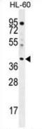 ELMO Domain Containing 2 antibody, AP51417PU-N, Origene, Western Blot image 