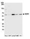WD Repeat Domain 1 antibody, A305-472A, Bethyl Labs, Western Blot image 