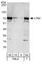 Proto-oncogene c-Rel antibody, A301-826A, Bethyl Labs, Western Blot image 