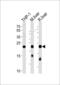 Glutathione Peroxidase 1 antibody, 63-890, ProSci, Western Blot image 