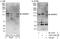 Sterol Regulatory Element Binding Transcription Factor 2 antibody, A303-125A, Bethyl Labs, Western Blot image 