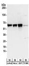 DnaJ Heat Shock Protein Family (Hsp40) Member C1 antibody, NBP2-32127, Novus Biologicals, Western Blot image 