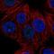 Zinc Finger Protein 778 antibody, NBP2-33637, Novus Biologicals, Immunocytochemistry image 