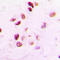 RAD50 Double Strand Break Repair Protein antibody, LS-C353235, Lifespan Biosciences, Immunohistochemistry paraffin image 