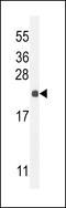 hCG_2024410 antibody, 55-580, ProSci, Western Blot image 