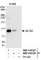 DNA-binding protein SATB2 antibody, NBP1-03327, Novus Biologicals, Western Blot image 