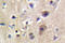 Ryanodine Receptor 2 antibody, LS-C176627, Lifespan Biosciences, Immunohistochemistry paraffin image 