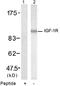 Insulin Like Growth Factor 1 Receptor antibody, AP08068PU-N, Origene, Western Blot image 