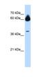 Carbonyl Reductase 3 antibody, orb330449, Biorbyt, Western Blot image 