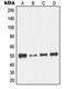 Nuclear Transcription Factor Y Subunit Gamma antibody, orb214318, Biorbyt, Western Blot image 
