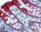 Keratin 18 antibody, LS-B3723, Lifespan Biosciences, Immunohistochemistry paraffin image 