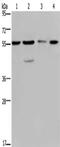 Nuclear pore complex protein Nup50 antibody, CSB-PA018458, Cusabio, Western Blot image 