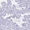 Uroplakin-1a antibody, PA5-62073, Invitrogen Antibodies, Immunohistochemistry paraffin image 