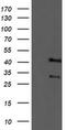 Tropomodulin 1 antibody, MA5-25612, Invitrogen Antibodies, Western Blot image 