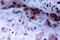 Janus Kinase 1 antibody, AP01620PU-N, Origene, Immunohistochemistry paraffin image 