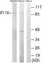 Gamma-interferon-inducible protein 16 antibody, A30690, Boster Biological Technology, Western Blot image 