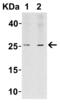 LIF Interleukin 6 Family Cytokine antibody, 6245, ProSci, Western Blot image 