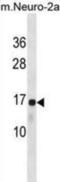 60S ribosomal protein L22 antibody, abx031251, Abbexa, Western Blot image 