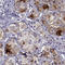Follitropin subunit beta antibody, HPA069703, Atlas Antibodies, Immunohistochemistry frozen image 