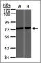 Transient Receptor Potential Cation Channel Subfamily V Member 2 antibody, AP23163PU-N, Origene, Western Blot image 