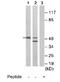 Zic Family Member 1 antibody, ab72694, Abcam, Western Blot image 