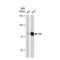 RIPK1 antibody, GTX09128, GeneTex, Western Blot image 