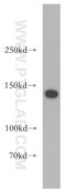 Structural Maintenance Of Chromosomes 3 antibody, 14185-1-AP, Proteintech Group, Western Blot image 