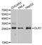 Oxidized Low Density Lipoprotein Receptor 1 antibody, TA332415, Origene, Western Blot image 
