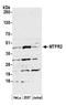 Mitochondrial Fission Regulator 2 antibody, A305-773A-M, Bethyl Labs, Western Blot image 