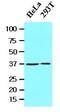 Laforin antibody, GTX53711, GeneTex, Western Blot image 