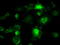B-Raf Proto-Oncogene, Serine/Threonine Kinase antibody, TA500441, Origene, Immunofluorescence image 