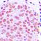 Jun Proto-Oncogene, AP-1 Transcription Factor Subunit antibody, orb214144, Biorbyt, Immunohistochemistry paraffin image 