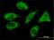 PIH1 Domain Containing 1 antibody, H00055011-M04, Novus Biologicals, Immunocytochemistry image 