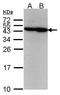 ERCC Excision Repair 8, CSA Ubiquitin Ligase Complex Subunit antibody, TA308479, Origene, Western Blot image 