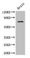 Serine/threonine-protein kinase MAK antibody, orb45958, Biorbyt, Western Blot image 