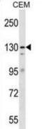 DNA repair protein complementing XP-G cells antibody, abx029850, Abbexa, Western Blot image 