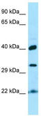 KTI12 Chromatin Associated Homolog antibody, TA337917, Origene, Western Blot image 