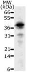 DNA Fragmentation Factor Subunit Beta antibody, GTX13592, GeneTex, Western Blot image 